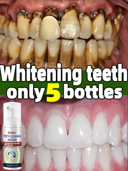 לקנות 10 מבין 12 חינם הלבנת שיניים משחת שיניים שיניים קצף נקי מוס פלאק הסרת כתמים להפחית צהוב תיקון, טיפול שיניים